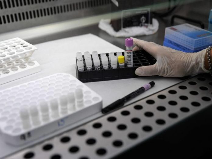 PRUEBAS CORONAVIRUS
