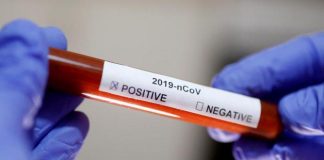 ESPAÑA REGISTRA SU MÁS BAJA CIFRA DE MUERTOS POR COVID19